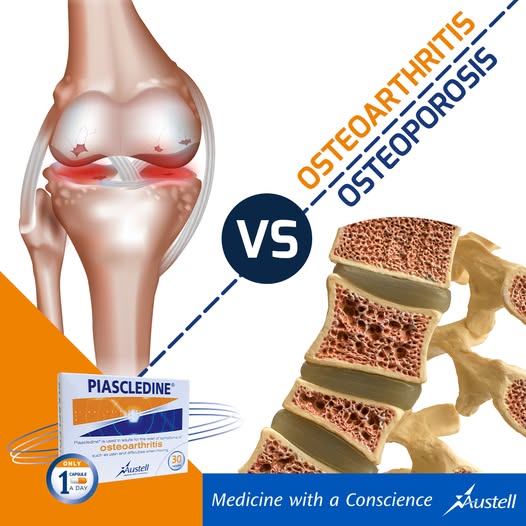 osteoarthritis vs osteoporosis